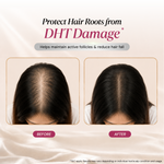 Promotional graphic for a hair protection product, showing a before-and-after comparison of a person's thinning hairline and dark hair. The text reads 'Protect Hair Roots from DHT Damage' and 'Helps maintain active follicles & reduce hair fall' on a soft beige background.